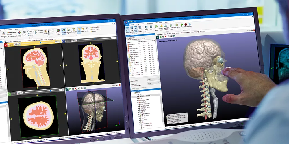 webinar-hbm (1)